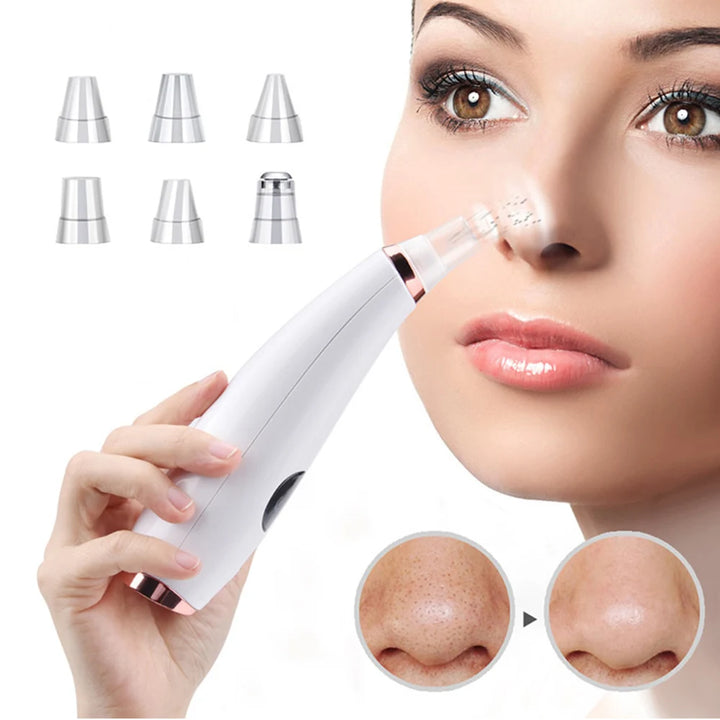 Portable Vacuum Blackhead Remover